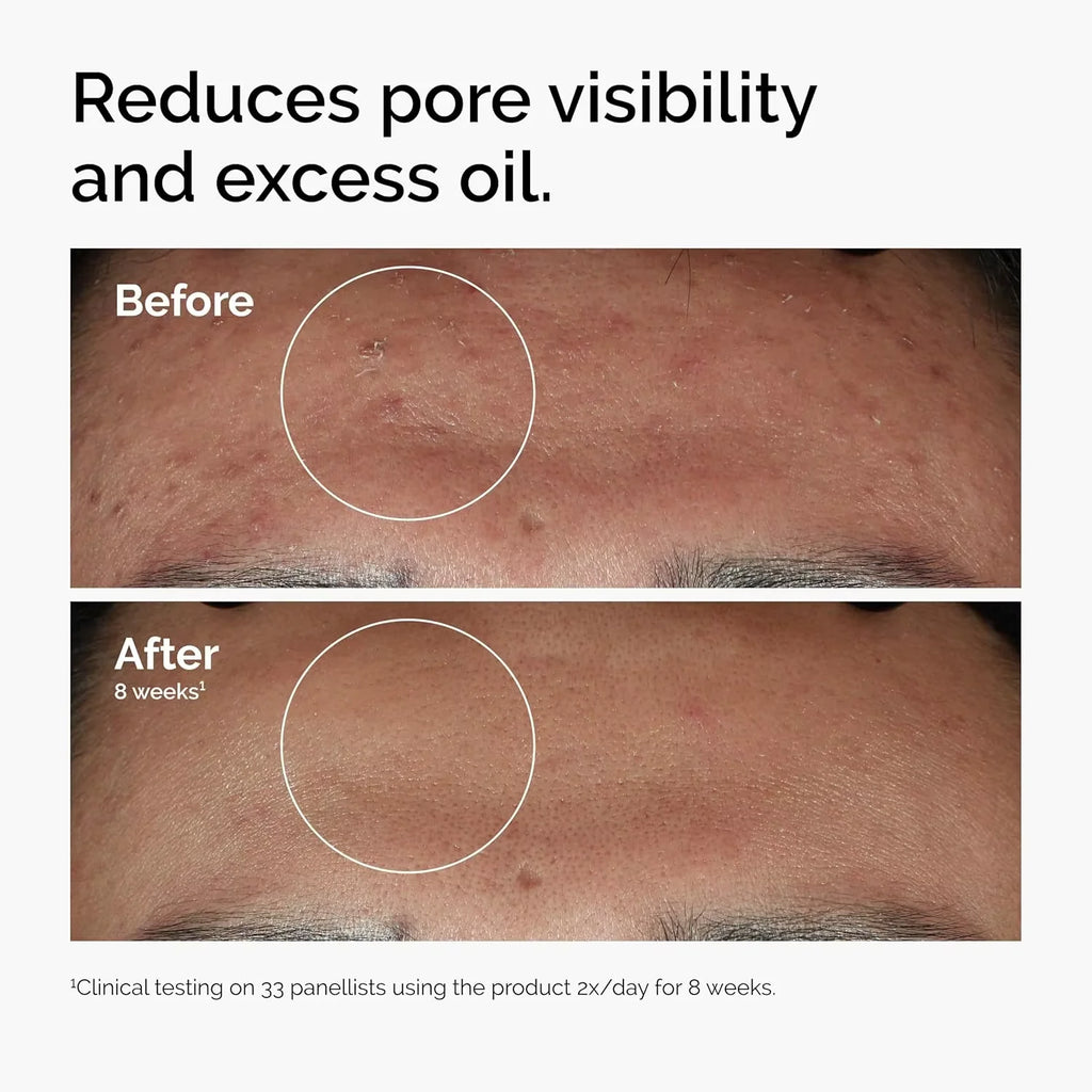 Niacinamide Glow Serum