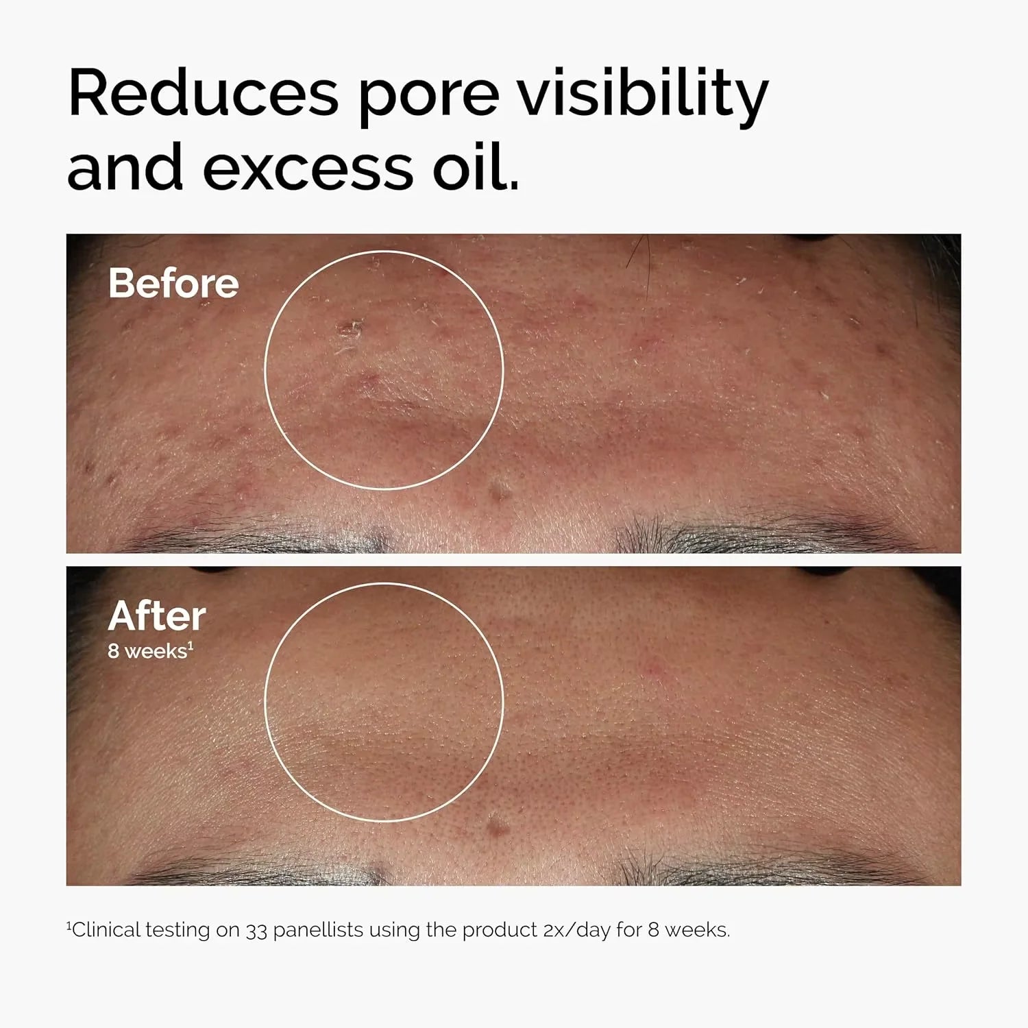 Niacinamide Glow Serum